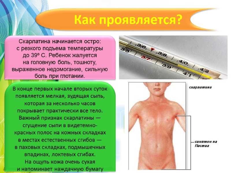 Как проявляется? Скарлатина начинается остро: с резкого подъема температуры до 39º C. Ребенок жалуется